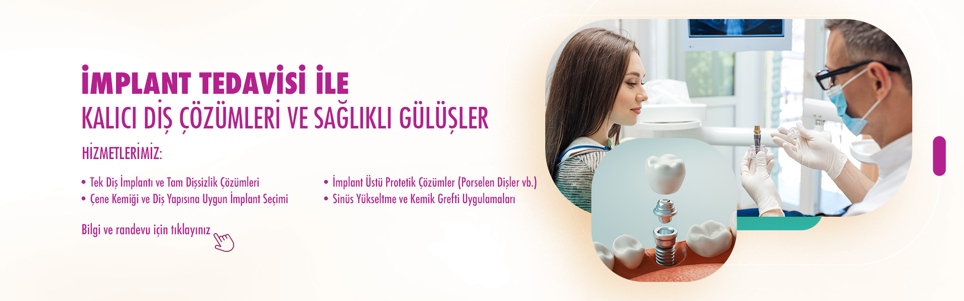 İmplant Tedavisi İle Kalıcı Diş Çözümleri ve Sağlıklı Gülüşler İmplant Tedavisi İle Kalıcı Diş Çözümleri ve Sağlıklı Gülüşler