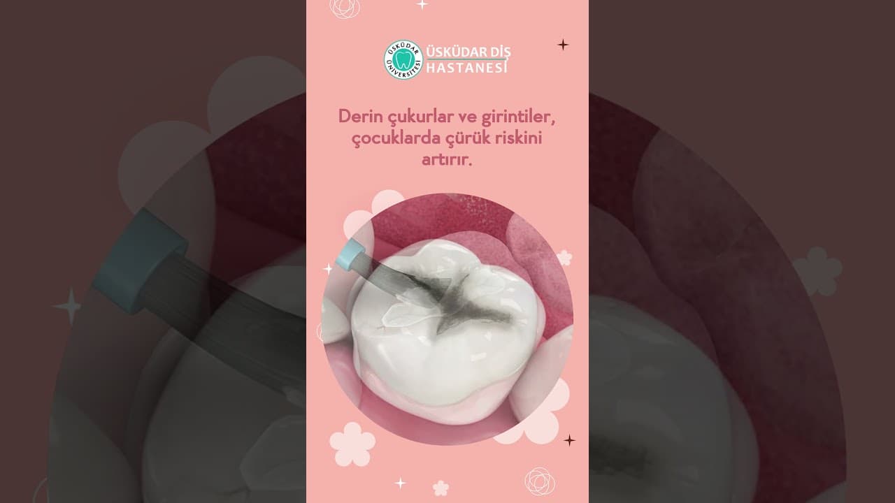 #shorts Çocuklarınızın dişlerini çürüklerden koruyun!-thumbnail